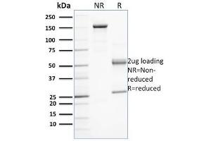 SDS-PAGE Analysis Purified PD-L1 Mouse Monoclonal Antibody (PDL1/2743).