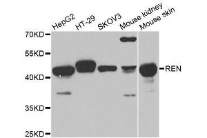 Western blot analysis of extracts of various cell lines, using REN antibody. (Renin antibody  (AA 24-160))