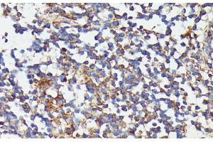 Immunohistochemistry of paraffin-embedded Human colon using CSF3 Polyclonal Antibody at dilution of 1:100 (40x lens). (G-CSF antibody)