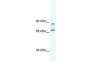WB Suggested Anti-DDX42 Antibody Titration:  0. (DDX42 antibody  (N-Term))