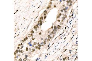 IHC analysis of CRTC3 using anti-CRTC3 antibody (ABIN7599779). (CRTC3 antibody  (AA 116-619))