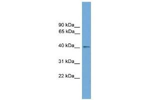 ZDHHC18 antibody used at 1 ug/ml to detect target protein. (ZDHHC18 antibody  (Middle Region))