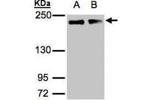 WB Image Sample(30 μg of whole cell lysate) A:A431, B:H1299 5% SDS PAGE antibody diluted at 1:1000 (Golgin A3 antibody  (C-Term))