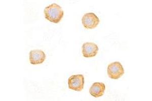 Immunocytochemistry of CARD10 in EL4 cells with CARD10 polyclonal antibody  at 10 ug/mL . (CARD10 antibody  (C-Term))