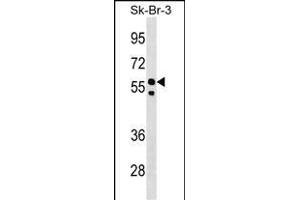 FBXO31 Antibody (Center) (ABIN1538289 and ABIN2848716) western blot analysis in SK-BR-3 cell line lysates (35 μg/lane). (FBXO31 antibody  (AA 310-338))