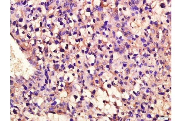 PLK1S1 antibody