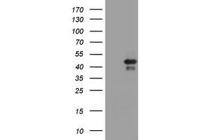Image no. 1 for anti-TIA1 Cytotoxic Granule-Associated RNA Binding Protein (TIA1) antibody (ABIN1501388) (TIA1 antibody)