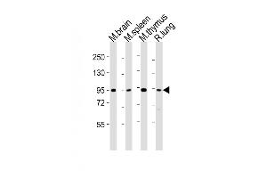 All lanes : Anti-Med15 Antibody (C-term) at 1:2000 dilution Lane 1: mouse brain lysates Lane 2: mouse spleen lysates Lane 3: mouse thymus lysates Lane 4: rat lung lysates Lysates/proteins at 20 μg per lane. (MED15 antibody  (C-Term))