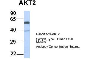 Host: Rabbit  Target Name: AKT2  Sample Tissue: Human Fetal Muscle  Antibody Dilution: 1. (AKT2 antibody  (Middle Region))