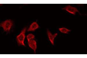 ABIN6266597 staining Hela by IF/ICC. (MMP7 antibody  (C-Term))