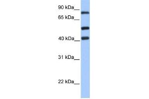 Human Jurkat; WB Suggested Anti-HCFC2 Antibody Titration: 0. (HCFC2 antibody  (C-Term))