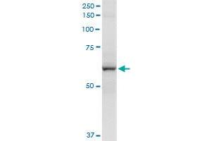 Immunoprecipitation of CYP2A13 transfected lysate using rabbit polyclonal anti-CYP2A13 and Protein A Magnetic Bead