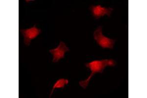 ABIN6267020 staining HuvEc by IF/ICC. (APC antibody  (pSer2054))