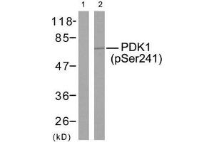 Western blot analysis of extracts from MDA-MB-435 cells using PDK1 (phospho-Ser241) antibody (E011005). (PDPK1 antibody  (pSer241))