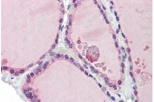 Immunohistochemistry (Paraffin-embedded Sections) (IHC (p)) image for anti-Leucine Zipper, Down-Regulated in Cancer 1 (LDOC1) (N-Term) antibody (ABIN462213)