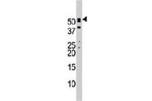 Western blot analysis of NUP50 polyclonal antibody  in mouse brain tissue lysate. (NUP50 antibody  (C-Term))