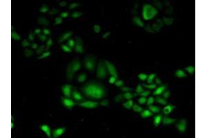 Detection of CDA in Human Hela Cells using Polyclonal Antibody to Cytidine Deaminase (CDA) (CDA antibody  (AA 2-146))