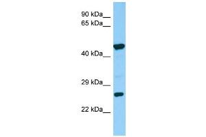 Host:  Rabbit  Target Name:  Sgcd  Sample Type:  Rat Small Intestine lysates  Antibody Dilution:  1. (SGCD antibody  (Middle Region))