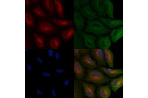 ABIN6265678 and ABIN6266689 staining  cells by IF/ICC. (TP53I11 antibody  (N-Term))