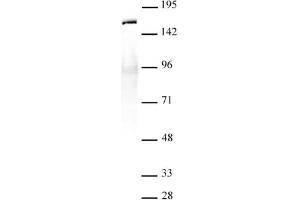 SMC1- α antibody (pAb) tested by Immunoprecipitation. (SMC1A antibody  (C-Term))