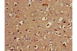 Immunohistochemistry of paraffin-embedded human brain tissue using ABIN7159316 at dilution of 1:100 (Melatonin Receptor 1B antibody  (AA 1-42))