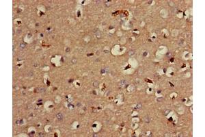 Immunohistochemistry of paraffin-embedded human brain tissue using ABIN7159316 at dilution of 1:100