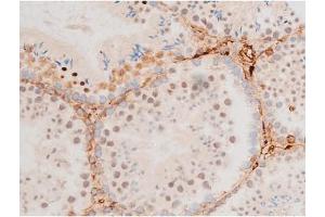 Immunohistochemistry (IHC) image for anti-GATA Binding Protein 4 (GATA4) (pSer262) antibody (ABIN6256227)
