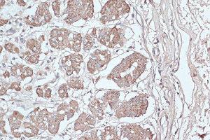 Immunohistochemistry of paraffin-embedded human stomach using MAP1LC3B antibody. (LC3B antibody)