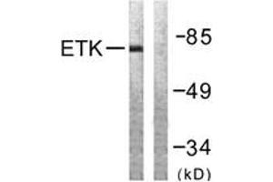 Western blot analysis of extracts from A549 cells, using ETK (Ab-566) Antibody. (BMX antibody  (AA 532-581))