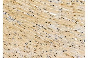 ABIN6259720 and ABIN6279067 at 1/100 staining Rat heart tissue by IHC-P.