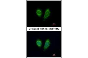 ICC/IF Image Immunofluorescence analysis of methanol-fixed HeLa, using DDX1, antibody at 1:200 dilution. (DDX1 antibody  (Internal Region))