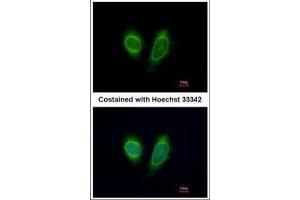 ICC/IF Image Immunofluorescence analysis of methanol-fixed HeLa, using DDX1, antibody at 1:200 dilution. (DDX1 antibody  (Internal Region))