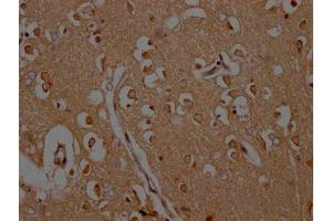 IHC image of ABIN7146439 diluted at 1:200 and staining in paraffin-embedded human brain tissue performed on a Leica BondTM system. (CAMK2A antibody  (AA 321-478))