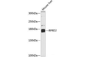 Western blot analysis of extracts of Mouse liver using RPRD2 Polyclonal Antibody at dilution of 1:3000. (RPRD2 antibody)