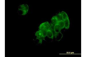 Immunofluorescence of monoclonal antibody to DNPEP on MCF-7 cell. (Aspartyl Aminopeptidase antibody  (AA 1-475))