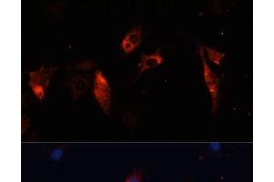 Immunofluorescence analysis of C6 cells using CTSL Polyclonal Antibody at dilution of 1:100. (Cathepsin L antibody)