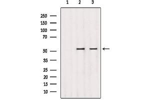 Western blot analysis of extracts from various samples, using DMAP1 Antibody. (DMAP1 antibody  (Internal Region))