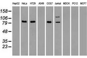 Western blot analysis of extracts (35 µg) from 9 different cell lines by using anti-anti-BRAFmonoclonal antibody. (BRAF antibody)
