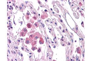 Immunohistochemistry (IHC) image for anti-HNF1 Homeobox A (HNF1A) (N-Term) antibody (ABIN2784536) (HNF1A antibody  (N-Term))