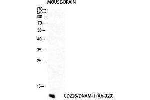 Western Blot (WB) analysis of Mouse Brain cells using DNAM-1 Polyclonal Antibody. (CD226 antibody  (Tyr570))