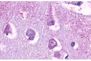 Anti-5HT5A Receptor antibody  ABIN1048276 IHC staining of human brain, neurons and glia. (Serotonin Receptor 5A antibody  (Cytoplasmic Domain))