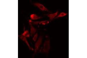 ABIN6275481 staining NIH-3T3 cells by IF/ICC. (RGS5 antibody  (Internal Region))