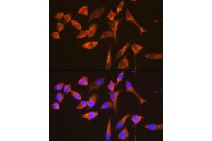Immunofluorescence (IF) image for anti-GTPase Activating Protein (SH3 Domain) Binding Protein 1 (G3BP1) antibody (ABIN1683144)