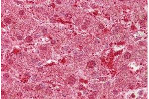 Anti-MST1 antibody IHC staining of human liver. (MST1 antibody  (AA 540-589))