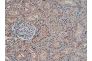 Detection of F2 in Rat Kidney Tissue using Polyclonal Antibody to Coagulation Factor II (F2) (Prothrombin antibody  (AA 324-617))