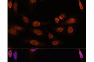 Immunofluorescence analysis of U-2 OS cells using THRB Polyclonal Antibody at dilution of 1:100. (THRB antibody)