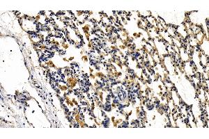 Detection of IRAK2 in Rat Lung Tissue using Polyclonal Antibody to Interleukin 1 Receptor Associated Kinase 2 (IRAK2) (IRAK2 antibody  (AA 211-458))