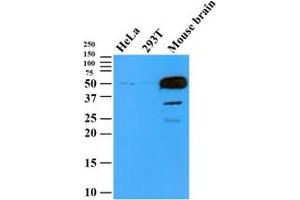 Cell lysates (35ug) were resolved by SDS-PAGE, transferred to PVDF membrane and probed with anti-human TUBB2b (1:500).