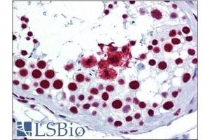 Human Testis: Formalin-Fixed, Paraffin-Embedded (FFPE) (SRSF3 antibody  (C-Term))