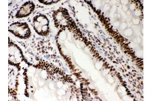 Immunohistochemistry (IHC) image for anti-Nucleophosmin (Nucleolar phosphoprotein B23, Numatrin) (NPM1) (AA 1-294) antibody (ABIN3042497)